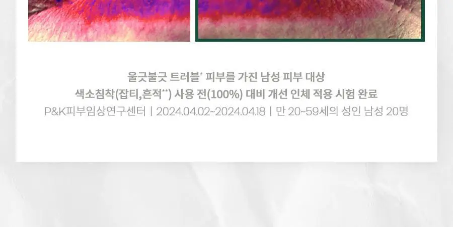 [선케어/반톤업] 닥터지 레드 블레미쉬 포 맨 올인원 톤 로션 50ml 기획 (+젠틀폼 30ml) 상세페이지 34
